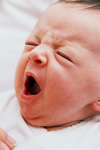 Hiccups in babies may be a serious medical problem