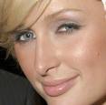 Even celebrities like Paris Hilton can get drooping eyes!