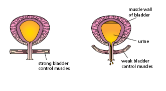 bladder control