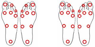Charcot foot testing is very important so treatment can start quickly