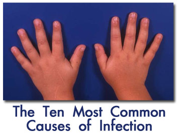 10 fingers on hands often causes of serious infections requiring Wound treatment center visit