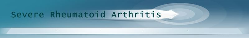 Welcome to Severe Rheumatoid Arthritis information source about Rheumatoid Arthritis