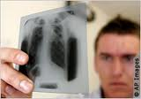 Doctors examination of lung disease patients x-ray